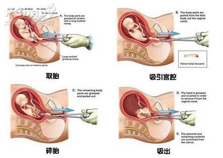 流产堕胎孩子会回来找妈妈，请超度他们的婴灵！