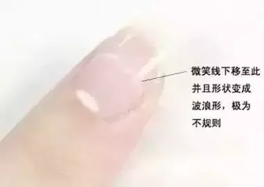 你的寿命有多长，看看你的手指头就知道了！