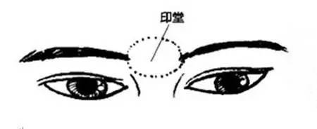 印堂发黑有血光之灾？是否有科学依据？