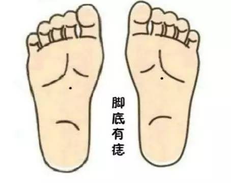 这些部位长痣的人，命里暗藏大富贵，早年吃苦，中年财源滚滚