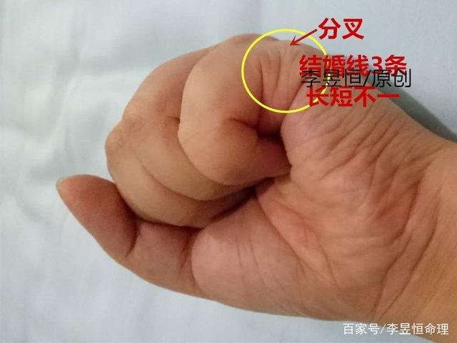 女人这种手相，手背如龟，钱财不断；手厚肉多有福人！