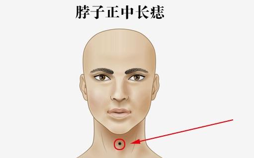 四种带财痣，福泽深厚，晚年光耀门楣