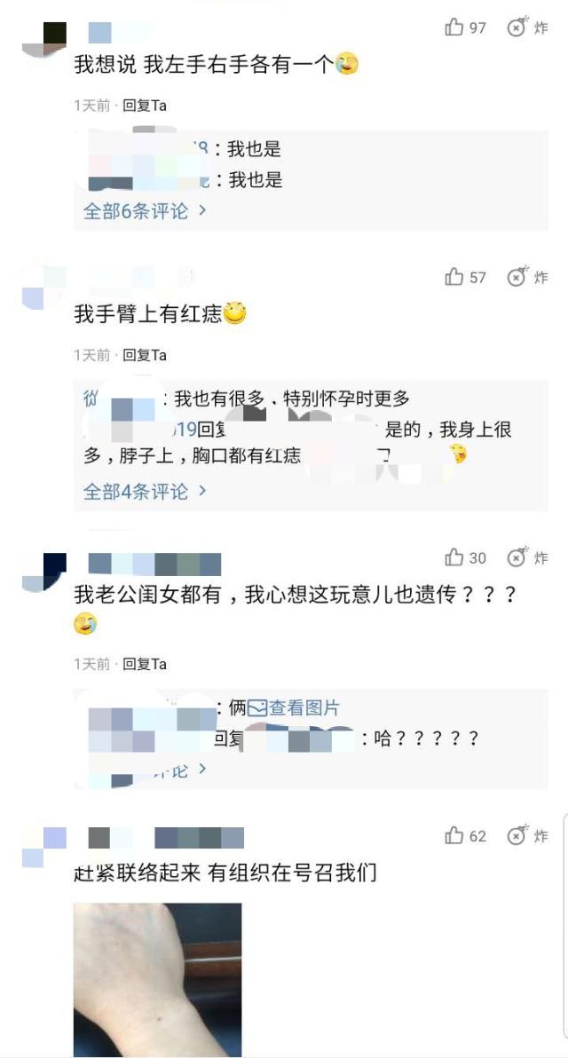 “食指的疤”后又一个全人类都有的特征：“手臂的痣”，你有吗？