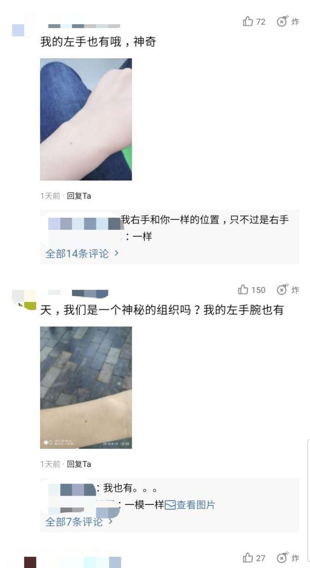 “食指的疤”后又一个全人类都有的特征：“手臂的痣”，你有吗？