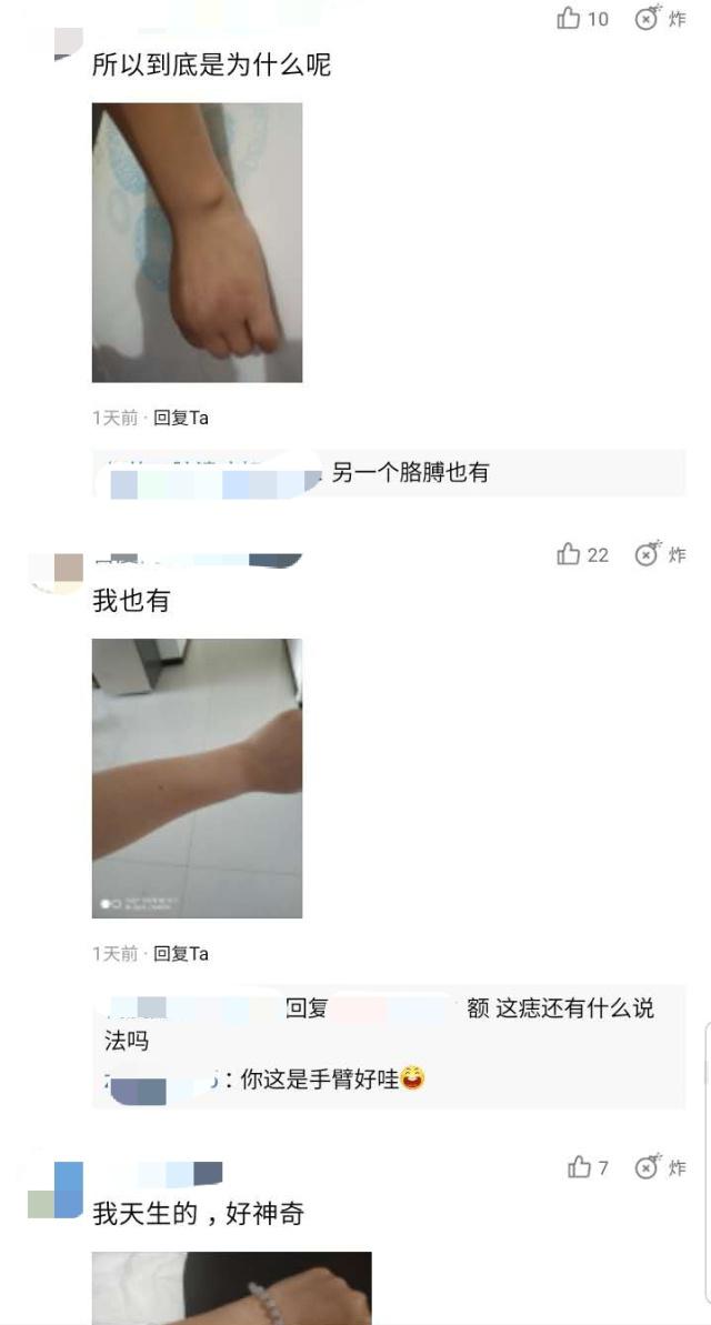 “食指的疤”后又一个全人类都有的特征：“手臂的痣”，你有吗？