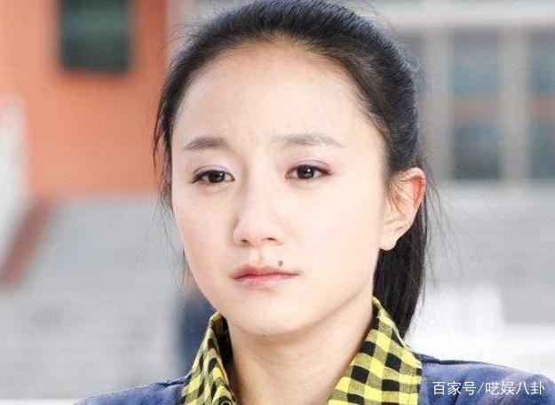 她演戏长达19年，嘴上一颗美人痣，如今将其点掉后，引起争议！