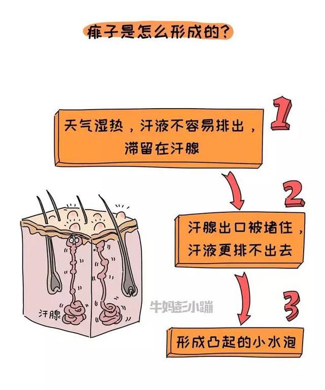 宝宝夏天总被蚊子叮，跟血型有关？有更招蚊子的血型吗？