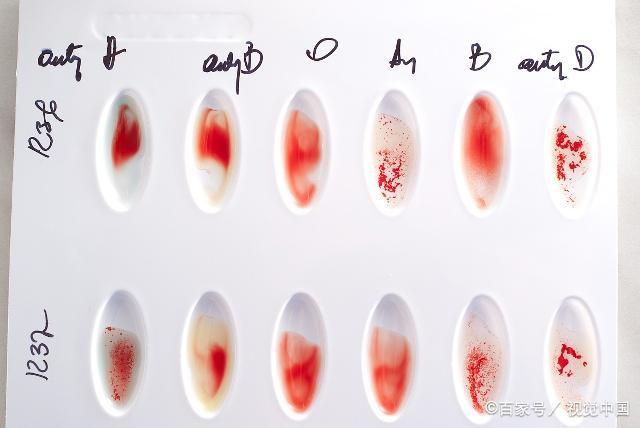 备孕小夫妻：关于血型遗传的小知识，你了解多少呢？